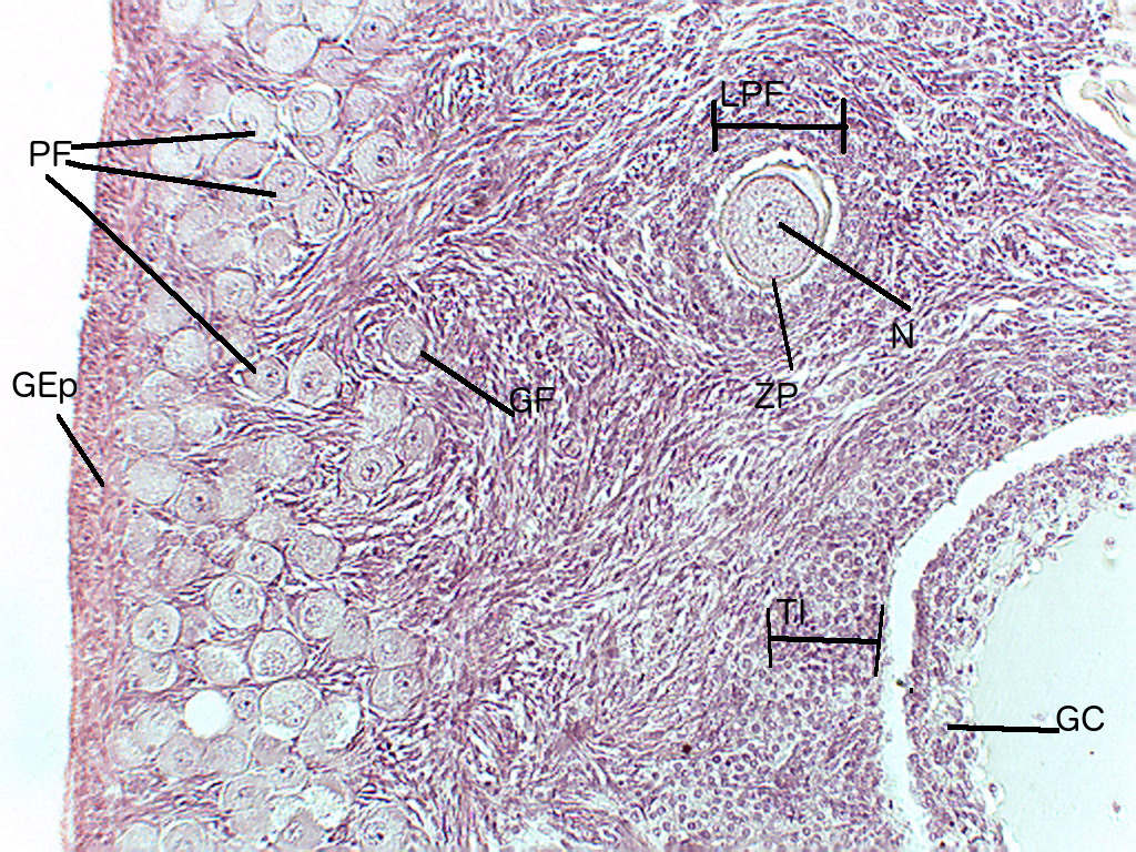 Ovary Under Microscope Labeled